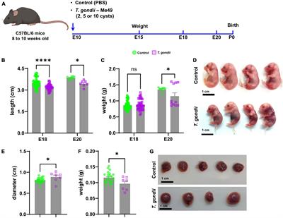 Maternal Toxoplasma gondii infection affects proliferation, differentiation and cell cycle regulation of retinal neural progenitor cells in mouse embryo